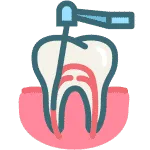 Endodonzia