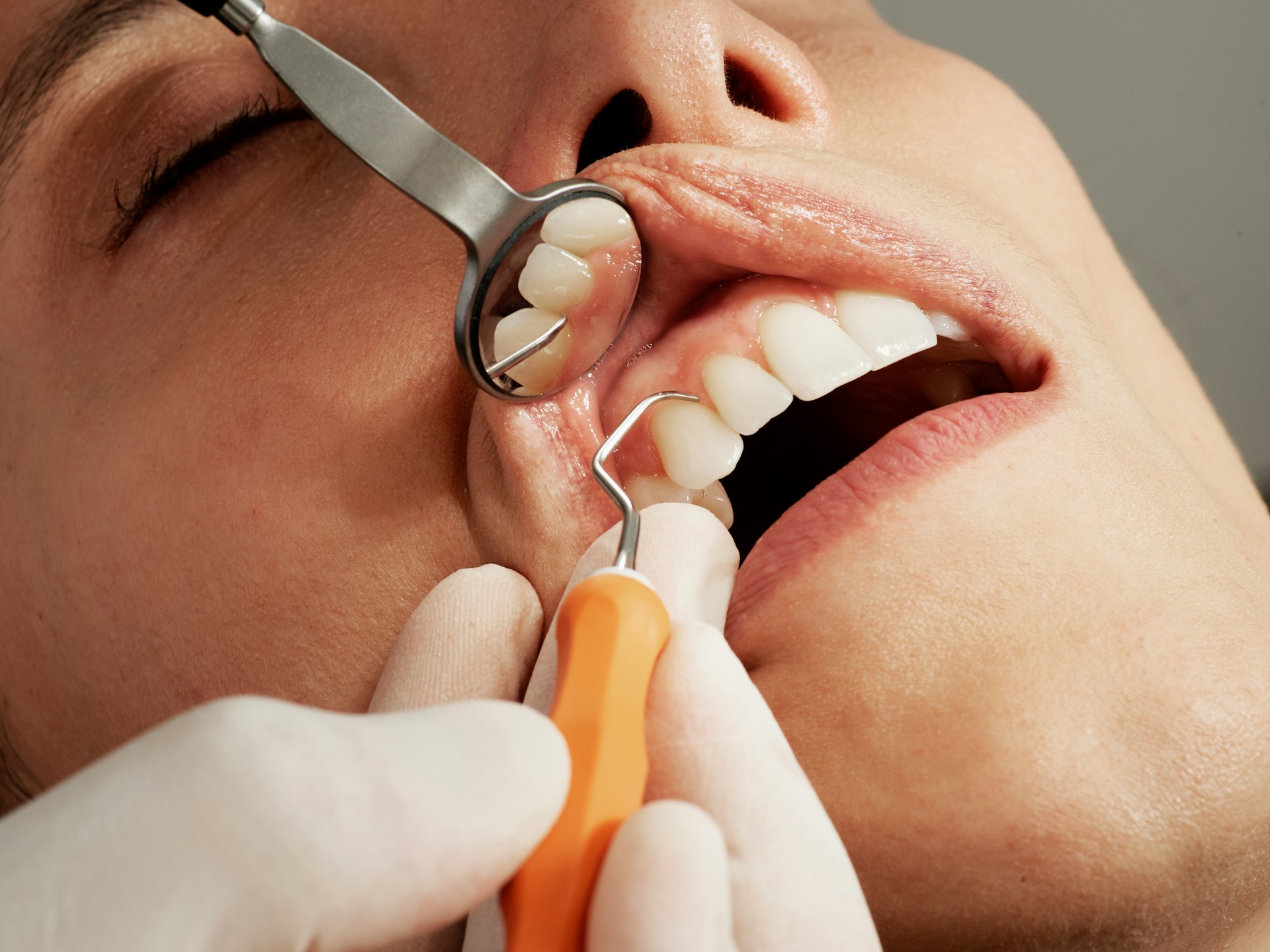 Quante volte all'anno bisogna andare dal dentista? (La risposta vi sorprenderà)