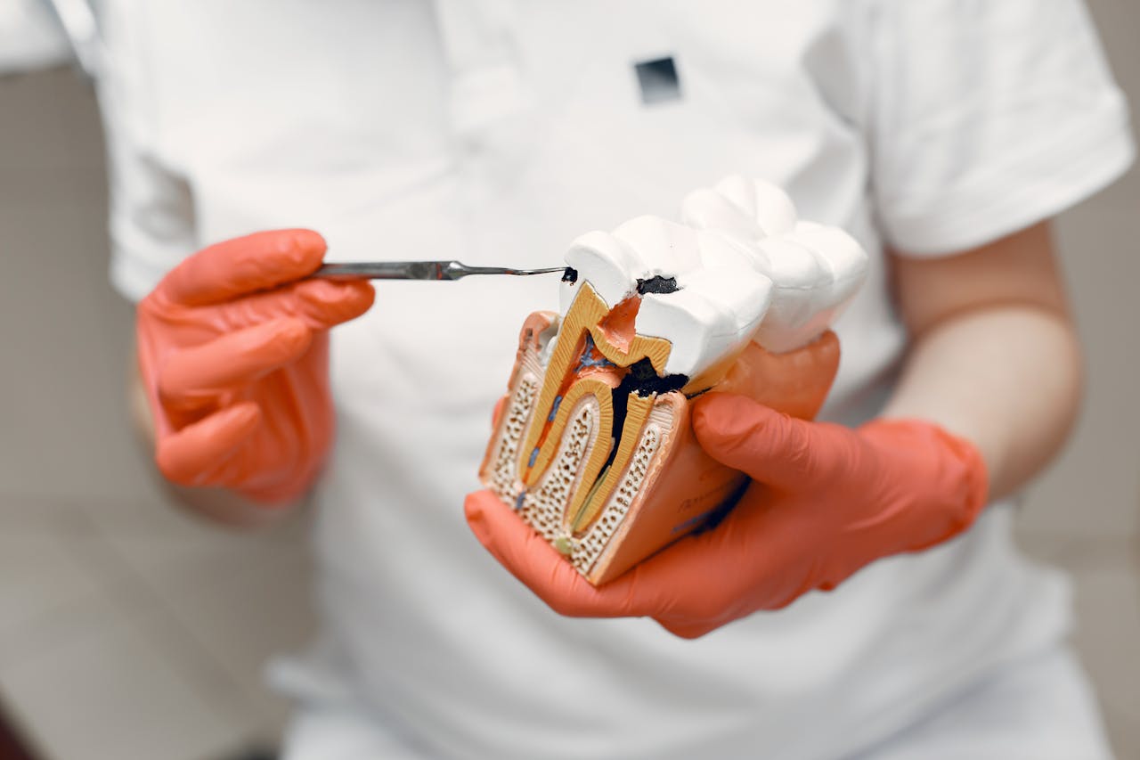 Carie dentali: cosa sono, come prevenirle e come si curano