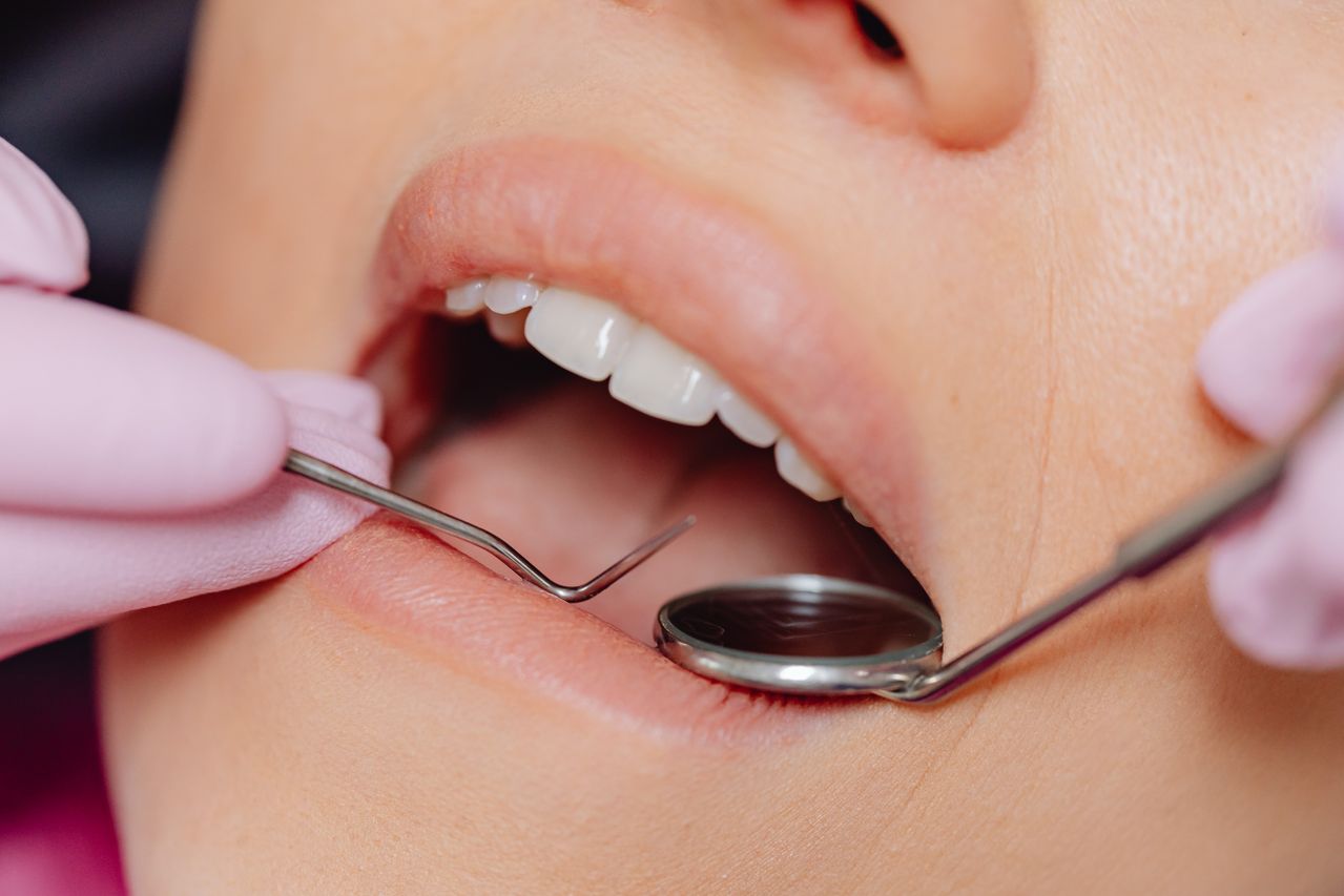 Pulizia dei denti professionale: ogni quanto farla e cosa aspettarsi