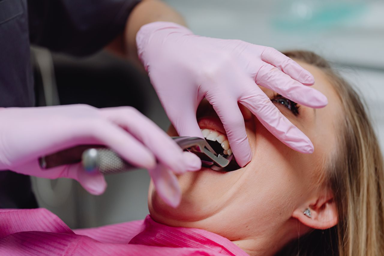 Ascesso dentale: sintomi, cause e perché non basta l'antibiotico